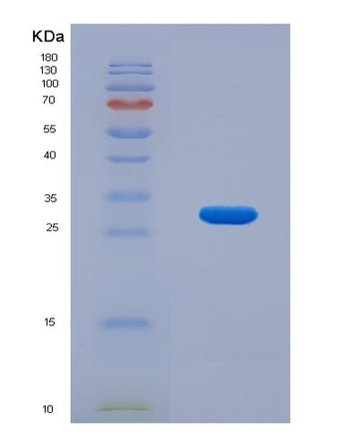 SDS-PAGE analysis of Mouse Prkdc (Dna-Dependent Protein Kinase Catalytic Subunit) - Recombinant Protein, CAT# BLT-08076P, showing >90% purity under 15% SDS-PAGE (Reduced)Mouse Prkdc (Dna-Dependent Protein Kinase Catalytic Subunit) - Recombinant Protein