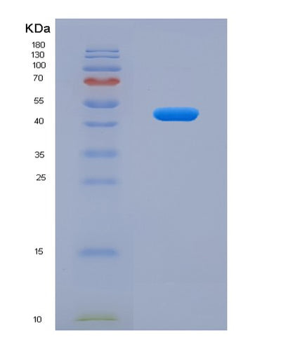 SDS-PAGE analysis of Human PRKDC (Dna-Dependent Protein Kinase Catalytic Subunit) - Recombinant Protein, CAT# BLT-08077P, showing >90% purity under 15% SDS-PAGE (Reduced)Human PRKDC (Dna-Dependent Protein Kinase Catalytic Subunit) - Recombinant Protein