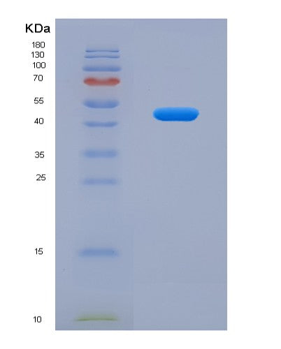 SDS-PAGE analysis of Human PRKDC (Dna-Dependent Protein Kinase Catalytic Subunit) - Recombinant Protein, CATHuman PRKDC (Dna-Dependent Protein Kinase Catalytic Subunit) - Recombinant Protein