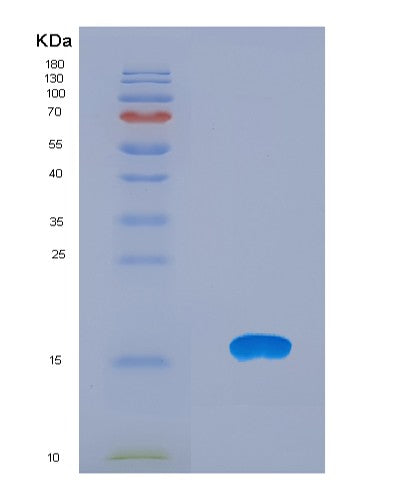 SDS-PAGE analysis of Human CXCL12 (Stromal Cell-Derived Factor 1) - Recombinant Protein, CATHuman CXCL12 (Stromal Cell-Derived Factor 1) - Recombinant Protein