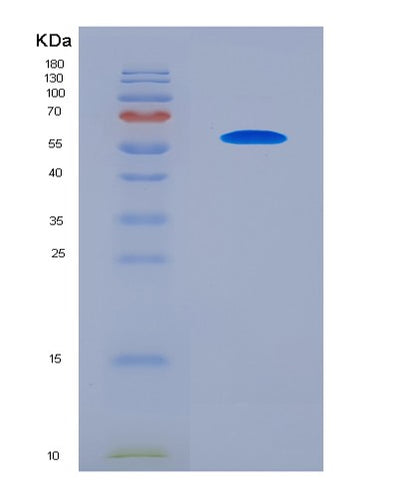 SDS-PAGE analysis of Human G3BP1 (Ras Gtpase-Activating Protein-Binding Protein 1) - Recombinant Protein, CAT# BLT-08079P, showing >90% purity under 15% SDS-PAGE (Reduced)Human G3BP1 (Ras Gtpase-Activating Protein-Binding Protein 1) - Recombinant Protein