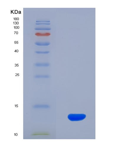 SDS-PAGE analysis of Human ADM2 (Protein Adm2) - Recombinant Protein, CAT# BLT-08080P, showing >90% purity under 15% SDS-PAGE (Reduced)Human ADM2 (Protein Adm2) - Recombinant Protein