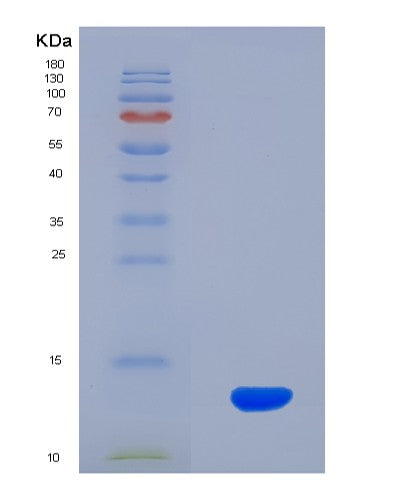 SDS-PAGE analysis of Human ADM2 (Protein Adm2) - Recombinant Protein, CATHuman ADM2 (Protein Adm2) - Recombinant Protein