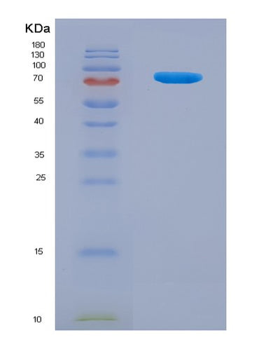 SDS-PAGE analysis of Mouse Pkm (Pyruvate Kinase Pkm) - Recombinant Protein, CAT# BLT-08081P, showing >90% purity under 15% SDS-PAGE (Reduced)Mouse Pkm (Pyruvate Kinase Pkm) - Recombinant Protein