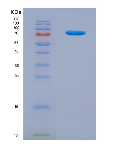 SDS-PAGE analysis of Mouse Pkm (Pyruvate Kinase Pkm) - Recombinant Protein, CATMouse Pkm (Pyruvate Kinase Pkm) - Recombinant Protein