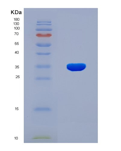 SDS-PAGE analysis of Human F8 (Coagulation Factor Viii) - Recombinant Protein, CATHuman F8 (Coagulation Factor Viii) - Recombinant Protein