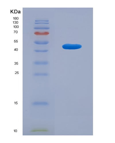 SDS-PAGE analysis of Human MAPT (Microtubule-Associated Protein Tau) - Recombinant Protein, CAT# BLT-08084P, showing >90% purity under 15% SDS-PAGE (Reduced)Human MAPT (Microtubule-Associated Protein Tau) - Recombinant Protein