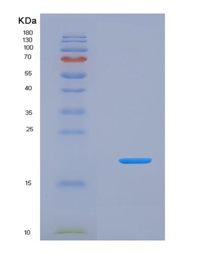SDS-PAGE analysis of Human CRBN (Protein Cereblon) - Recombinant Protein, CAT# BLT-08089P, showing >90% purity under 15% SDS-PAGE (Reduced)Human CRBN (Protein Cereblon) - Recombinant Protein