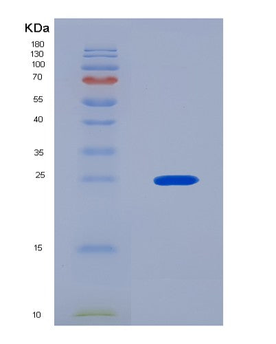 SDS-PAGE analysis of Human LRP2 (Low-Density Lipoprotein Receptor-Related Protein 2) - Recombinant Protein, CATHuman LRP2 (Low-Density Lipoprotein Receptor-Related Protein 2) - Recombinant Protein