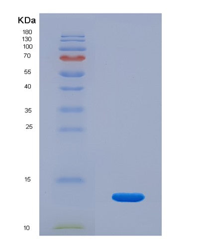 SDS-PAGE analysis of Human ZDHHC5 (Palmitoyltransferase Zdhhc5) - Recombinant Protein, CATHuman ZDHHC5 (Palmitoyltransferase Zdhhc5) - Recombinant Protein