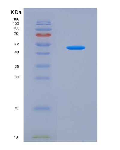 SDS-PAGE analysis of Human SEMA6D (Semaphorin-6D) - Recombinant Protein, CAT# BLT-08092P, showing >90% purity under 15% SDS-PAGE (Reduced)Human SEMA6D (Semaphorin-6D) - Recombinant Protein