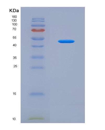 SDS-PAGE analysis of Human SEMA6D (Semaphorin-6D) - Recombinant Protein, CATHuman SEMA6D (Semaphorin-6D) - Recombinant Protein