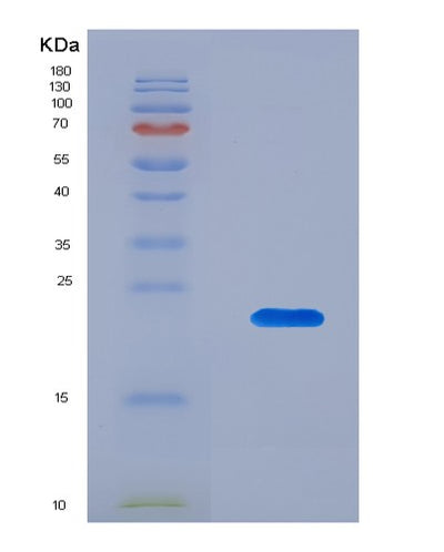 SDS-PAGE analysis of Human APRT (Adenine Phosphoribosyltransferase) - Recombinant Protein, CAT# BLT-08093P, showing >90% purity under 15% SDS-PAGE (Reduced)Human APRT (Adenine Phosphoribosyltransferase) - Recombinant Protein