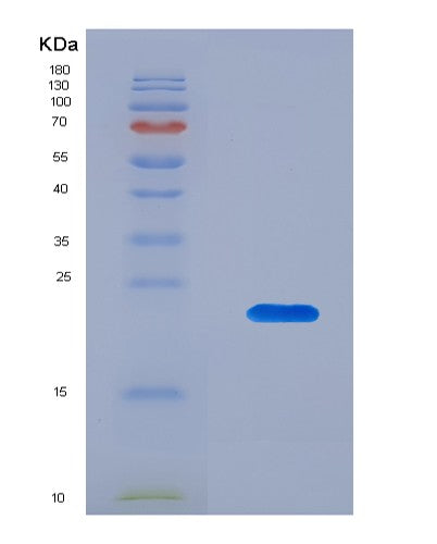 SDS-PAGE analysis of Human APRT (Adenine Phosphoribosyltransferase) - Recombinant Protein, CATHuman APRT (Adenine Phosphoribosyltransferase) - Recombinant Protein