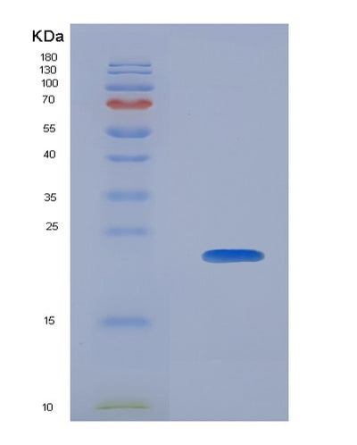 SDS-PAGE analysis of Human CALM3 (Calmodulin-3) - Recombinant Protein, CAT# BLT-08094P, showing >90% purity under 15% SDS-PAGE (Reduced)Human CALM3 (Calmodulin-3) - Recombinant Protein