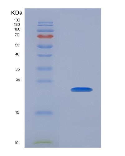 SDS-PAGE analysis of Human CALM3 (Calmodulin-3) - Recombinant Protein, CATHuman CALM3 (Calmodulin-3) - Recombinant Protein