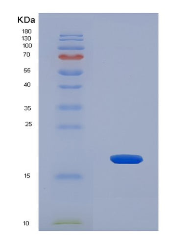 SDS-PAGE analysis of Human PLP2 (Proteolipid Protein 2) - Recombinant Protein, CAT# BLT-08095P, showing >90% purity under 15% SDS-PAGE (Reduced)Human PLP2 (Proteolipid Protein 2) - Recombinant Protein