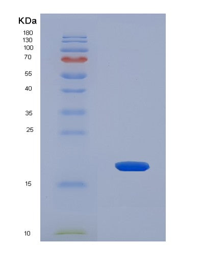 SDS-PAGE analysis of Human PLP2 (Proteolipid Protein 2) - Recombinant Protein, CATHuman PLP2 (Proteolipid Protein 2) - Recombinant Protein