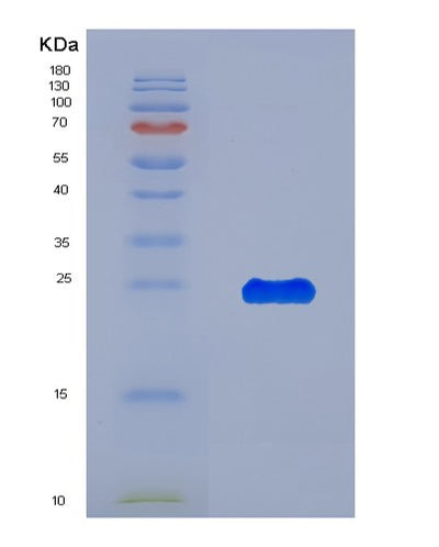SDS-PAGE analysis of Human SEC23A (Protein Transport Protein Sec23A) - Recombinant Protein, CAT# BLT-08096P, showing >90% purity under 15% SDS-PAGE (Reduced)Human SEC23A (Protein Transport Protein Sec23A) - Recombinant Protein