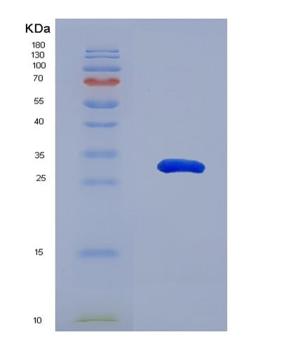 SDS-PAGE analysis of Human ERP29 (Endoplasmic Reticulum Resident Protein 29) - Recombinant Protein, CAT# BLT-08098P, showing >90% purity under 15% SDS-PAGE (Reduced)Human ERP29 (Endoplasmic Reticulum Resident Protein 29) - Recombinant Protein