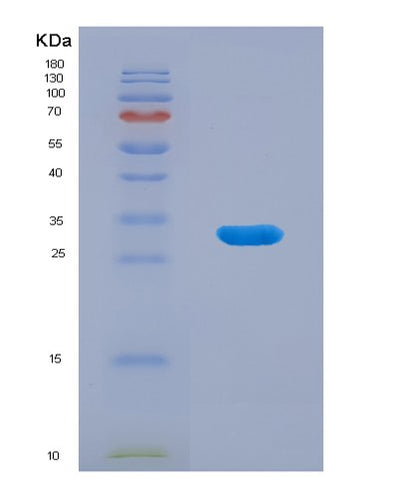SDS-PAGE analysis of Human CCDC81 (Coiled-Coil Domain-Containing Protein 81) - Recombinant Protein, CAT# BLT-08099P, showing >90% purity under 15% SDS-PAGE (Reduced)Human CCDC81 (Coiled-Coil Domain-Containing Protein 81) - Recombinant Protein