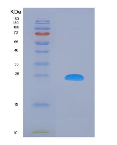 SDS-PAGE analysis of Human MLLT10 (Protein Af-10) - Recombinant Protein, CAT# BLT-08100P, showing >90% purity under 15% SDS-PAGE (Reduced)Human MLLT10 (Protein Af-10) - Recombinant Protein