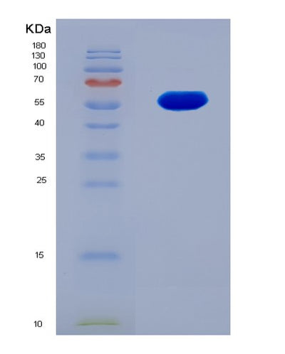 SDS-PAGE analysis of Human CDK12 (Cyclin-Dependent Kinase 12) - Recombinant Protein, CAT# BLT-08103P, showing >90% purity under 15% SDS-PAGE (Reduced)Human CDK12 (Cyclin-Dependent Kinase 12) - Recombinant Protein