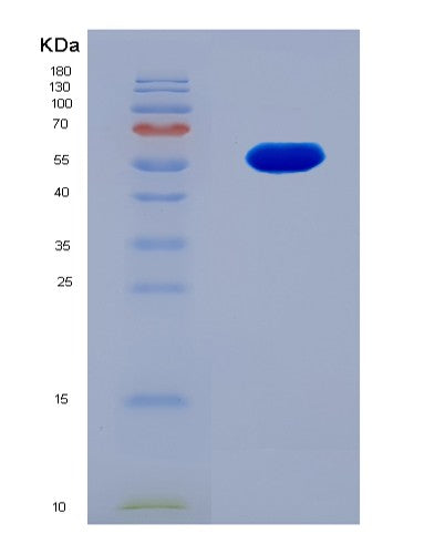 SDS-PAGE analysis of Human CDK12 (Cyclin-Dependent Kinase 12) - Recombinant Protein, CATHuman CDK12 (Cyclin-Dependent Kinase 12) - Recombinant Protein