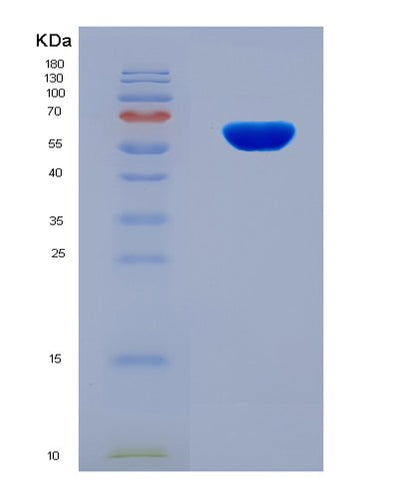 SDS-PAGE analysis of Human CDK13 (Cyclin-Dependent Kinase 13) - Recombinant Protein, CAT# BLT-08104P, showing >90% purity under 15% SDS-PAGE (Reduced)Human CDK13 (Cyclin-Dependent Kinase 13) - Recombinant Protein