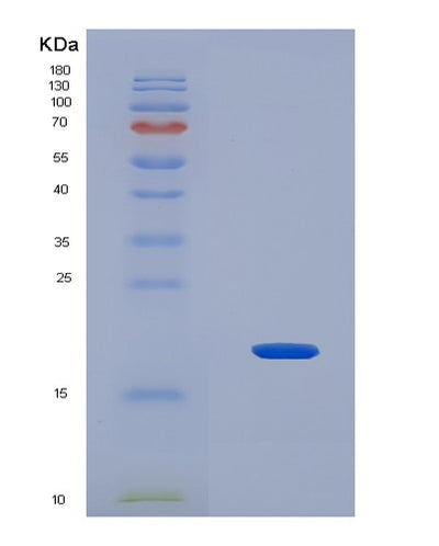 SDS-PAGE analysis of Mouse Hmgn2 (Non-Histone Chromosomal Protein Hmg-17) - Recombinant Protein, CAT# BLT-08106P, showing >90% purity under 15% SDS-PAGE (Reduced)Mouse Hmgn2 (Non-Histone Chromosomal Protein Hmg-17) - Recombinant Protein