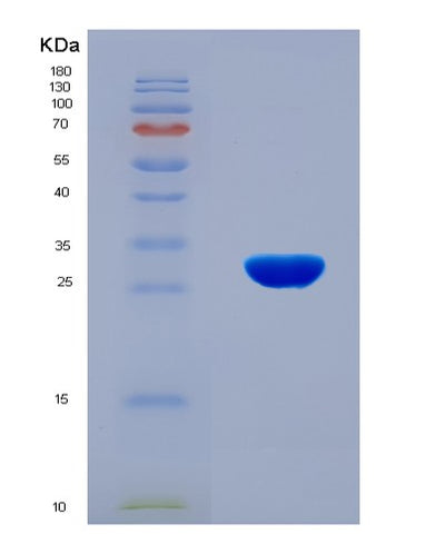 SDS-PAGE analysis of Human CCR6 (C-C Chemokine Receptor Type 6) - Recombinant Protein, CAT# BLT-08108P, showing >90% purity under 15% SDS-PAGE (Reduced)Human CCR6 (C-C Chemokine Receptor Type 6) - Recombinant Protein
