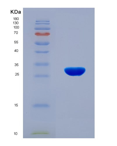 SDS-PAGE analysis of Human CCR6 (C-C Chemokine Receptor Type 6) - Recombinant Protein, CATHuman CCR6 (C-C Chemokine Receptor Type 6) - Recombinant Protein