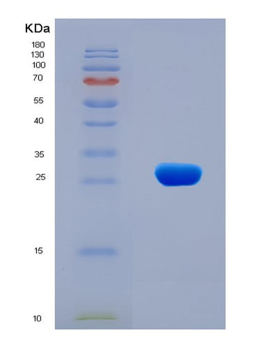 SDS-PAGE analysis of Human CCR1 (C-C Chemokine Receptor Type 1) - Recombinant Protein, CAT# BLT-08109P, showing >90% purity under 15% SDS-PAGE (Reduced)Human CCR1 (C-C Chemokine Receptor Type 1) - Recombinant Protein