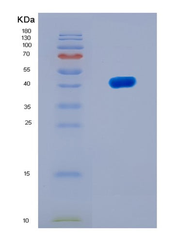 SDS-PAGE analysis of Mouse Obp2a (Odorant-Binding Protein 2A) - Recombinant Protein, CAT# BLT-08110P, showing >90% purity under 15% SDS-PAGE (Reduced)Mouse Obp2a (Odorant-Binding Protein 2A) - Recombinant Protein