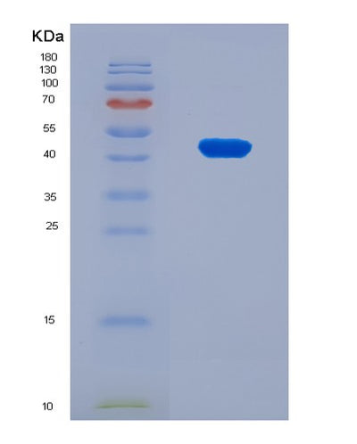 SDS-PAGE analysis of Human SERPINA4 (Kallistatin) - Recombinant Protein, CAT# BLT-08112P, showing >90% purity under 15% SDS-PAGE (Reduced)Human SERPINA4 (Kallistatin) - Recombinant Protein