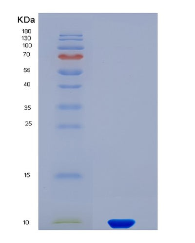 SDS-PAGE analysis of Human IAPP (Islet Amyloid Polypeptide) - Recombinant Protein, CAT# BLT-08114P, showing >90% purity under 15% SDS-PAGE (Reduced)Human IAPP (Islet Amyloid Polypeptide) - Recombinant Protein