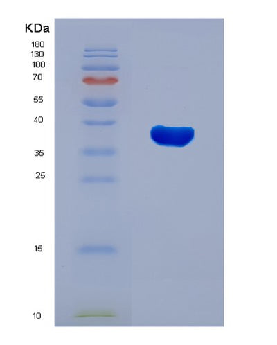 SDS-PAGE analysis of Human RNF126 (E3 Ubiquitin-Protein Ligase Rnf126) - Recombinant Protein, CAT# BLT-08115P, showing >90% purity under 15% SDS-PAGE (Reduced)Human RNF126 (E3 Ubiquitin-Protein Ligase Rnf126) - Recombinant Protein