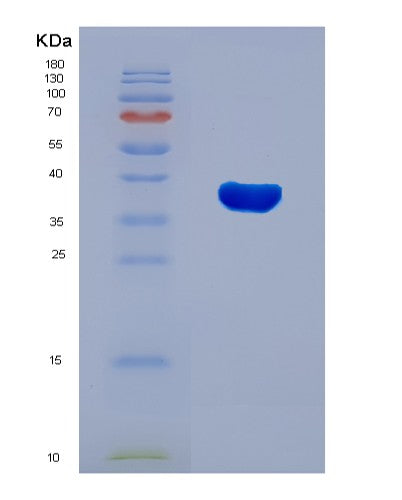 SDS-PAGE analysis of Human RNF126 (E3 Ubiquitin-Protein Ligase Rnf126) - Recombinant Protein, CATHuman RNF126 (E3 Ubiquitin-Protein Ligase Rnf126) - Recombinant Protein