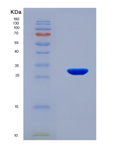 SDS-PAGE analysis of Human NEFM (Neurofilament Medium Polypeptide) - Recombinant Protein, CAT# BLT-08116P, showing >90% purity under 15% SDS-PAGE (Reduced)Human NEFM (Neurofilament Medium Polypeptide) - Recombinant Protein