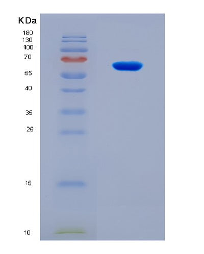 SDS-PAGE analysis of Human CDK1 (Cyclin-Dependent Kinase 1) - Recombinant Protein, CAT# BLT-08117P, showing >90% purity under 15% SDS-PAGE (Reduced)Human CDK1 (Cyclin-Dependent Kinase 1) - Recombinant Protein