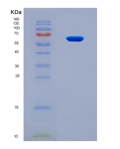 SDS-PAGE analysis of Human CDK1 (Cyclin-Dependent Kinase 1) - Recombinant Protein, CATHuman CDK1 (Cyclin-Dependent Kinase 1) - Recombinant Protein