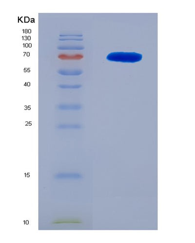 SDS-PAGE analysis of Human CCNB1 (G2/Mitotic-Specific Cyclin-B1) - Recombinant Protein, CAT# BLT-08118P, showing >90% purity under 15% SDS-PAGE (Reduced)Human CCNB1 (G2/Mitotic-Specific Cyclin-B1) - Recombinant Protein