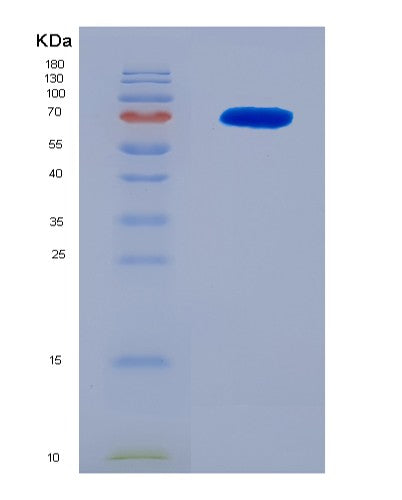SDS-PAGE analysis of Human CCNB1 (G2/Mitotic-Specific Cyclin-B1) - Recombinant Protein, CATHuman CCNB1 (G2/Mitotic-Specific Cyclin-B1) - Recombinant Protein