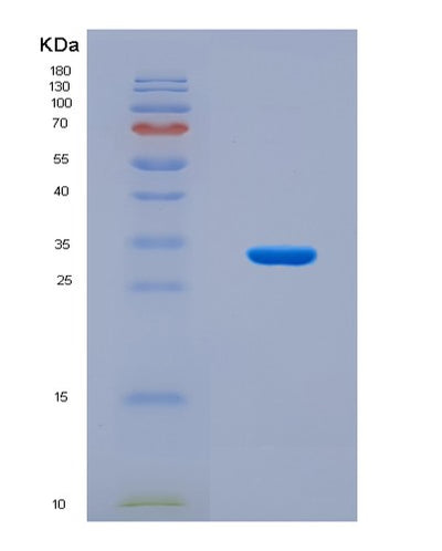 SDS-PAGE analysis of Human ZCRB1 (Zinc Finger Cchc-Type And Rna-Binding Motif-Containing Protein 1) - Recombinant Protein, CAT# BLT-08119P, showing >90% purity under 15% SDS-PAGE (Reduced)Human ZCRB1 (Zinc Finger Cchc-Type And Rna-Binding Motif-Containing Protein 1) - Recombinant Protein