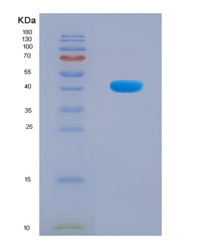 SDS-PAGE analysis of Human RTCA (Rna 3'-Terminal Phosphate Cyclase) - Recombinant Protein, CAT# BLT-08120P, showing >90% purity under 15% SDS-PAGE (Reduced)Human RTCA (Rna 3'-Terminal Phosphate Cyclase) - Recombinant Protein