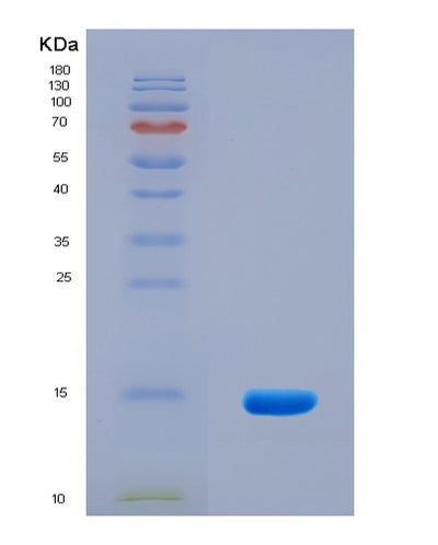 SDS-PAGE analysis of Human UBAP2 (Ubiquitin-Associated Protein 2) - Recombinant Protein, CAT# BLT-08121P, showing >90% purity under 15% SDS-PAGE (Reduced)Human UBAP2 (Ubiquitin-Associated Protein 2) - Recombinant Protein