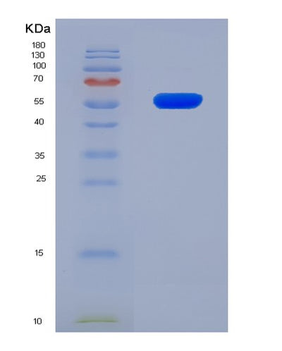 SDS-PAGE analysis of Human PI16 (Peptidase Inhibitor 16) - Recombinant Protein, CAT# BLT-08122P, showing >90% purity under 15% SDS-PAGE (Reduced)Human PI16 (Peptidase Inhibitor 16) - Recombinant Protein