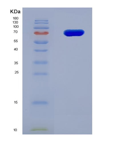 SDS-PAGE analysis of Human USP5 (Ubiquitin Carboxyl-Terminal Hydrolase 5) - Recombinant Protein, CAT# BLT-08123P, showing >90% purity under 15% SDS-PAGE (Reduced)Human USP5 (Ubiquitin Carboxyl-Terminal Hydrolase 5) - Recombinant Protein
