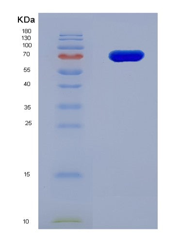 SDS-PAGE analysis of Human USP5 (Ubiquitin Carboxyl-Terminal Hydrolase 5) - Recombinant Protein, CATHuman USP5 (Ubiquitin Carboxyl-Terminal Hydrolase 5) - Recombinant Protein