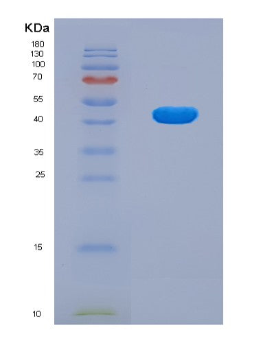 SDS-PAGE analysis of Human CAD (Multifunctional Protein Cad) - Recombinant Protein, CATHuman CAD (Multifunctional Protein Cad) - Recombinant Protein